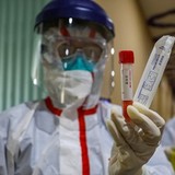 Очень интересные сведения о зараженности тестов на COVID-19 Очень интересные сведения о зараженности тестов на COVID-19